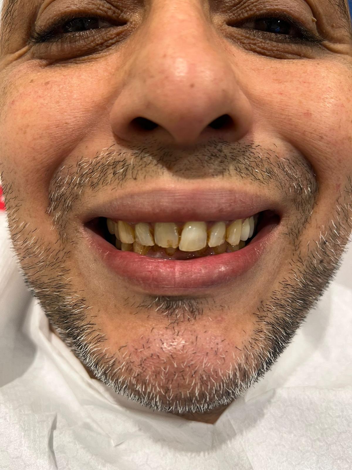 ECE Dental Patient Transformation